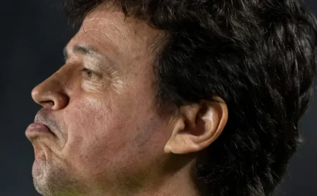 Fernando Diniz Sente Muito Pressão no Vasco e Possível Saída em Caso de Eliminação na Copa do Brasil