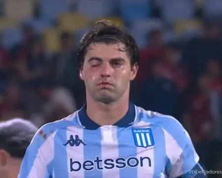 Sosa Fratura o Maxilar e Prejudica o Racing no Confronto contra o Flamengo pela Libertadores Sosa Fratura o Maxilar e Prejudica o Racing no Confronto contra o Flamengo pela Libertadores