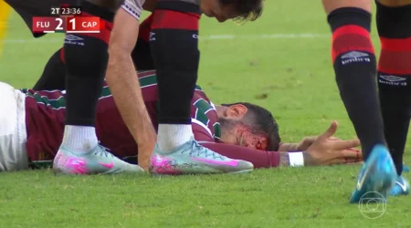 Fluminense: Freytes preservado com corte no supercílio; veja lista de relacionados