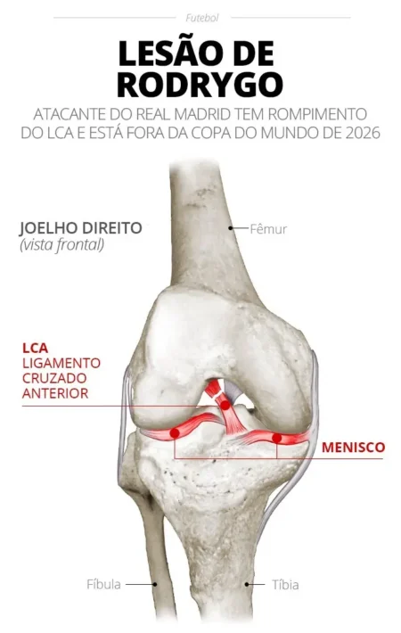 Rodrygo, do Real Madrid, fará cirurgia no joelho direito nesta terça-feira