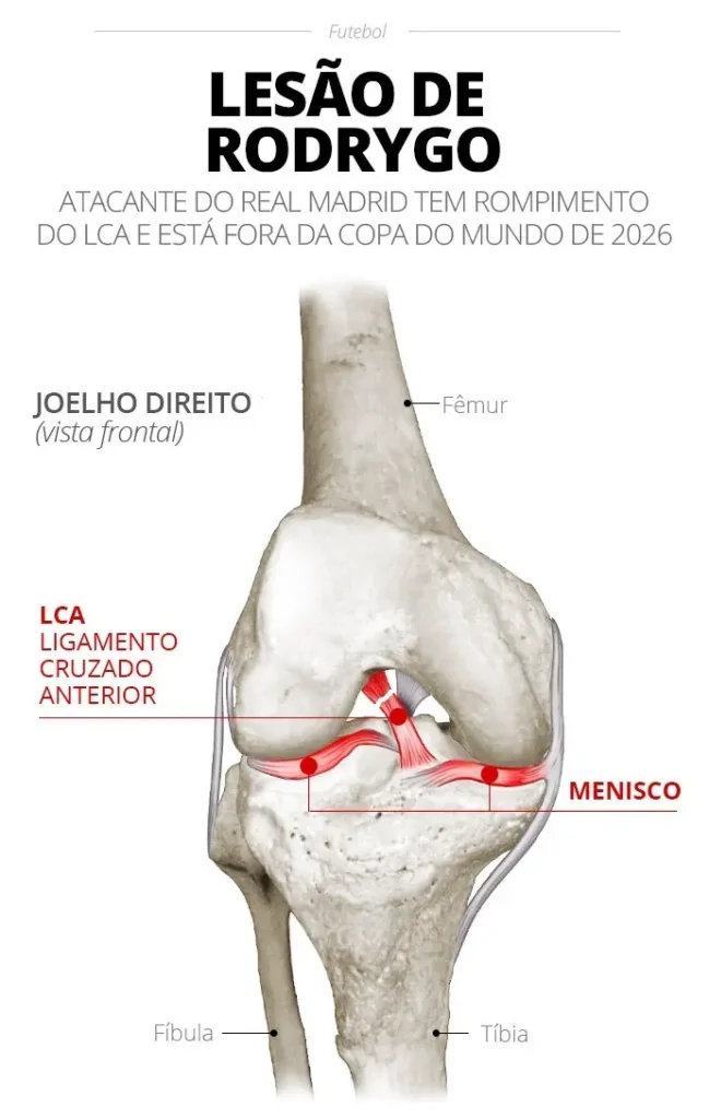 Rodrygo, do Real Madrid, fará cirurgia no joelho direito nesta terça-feira